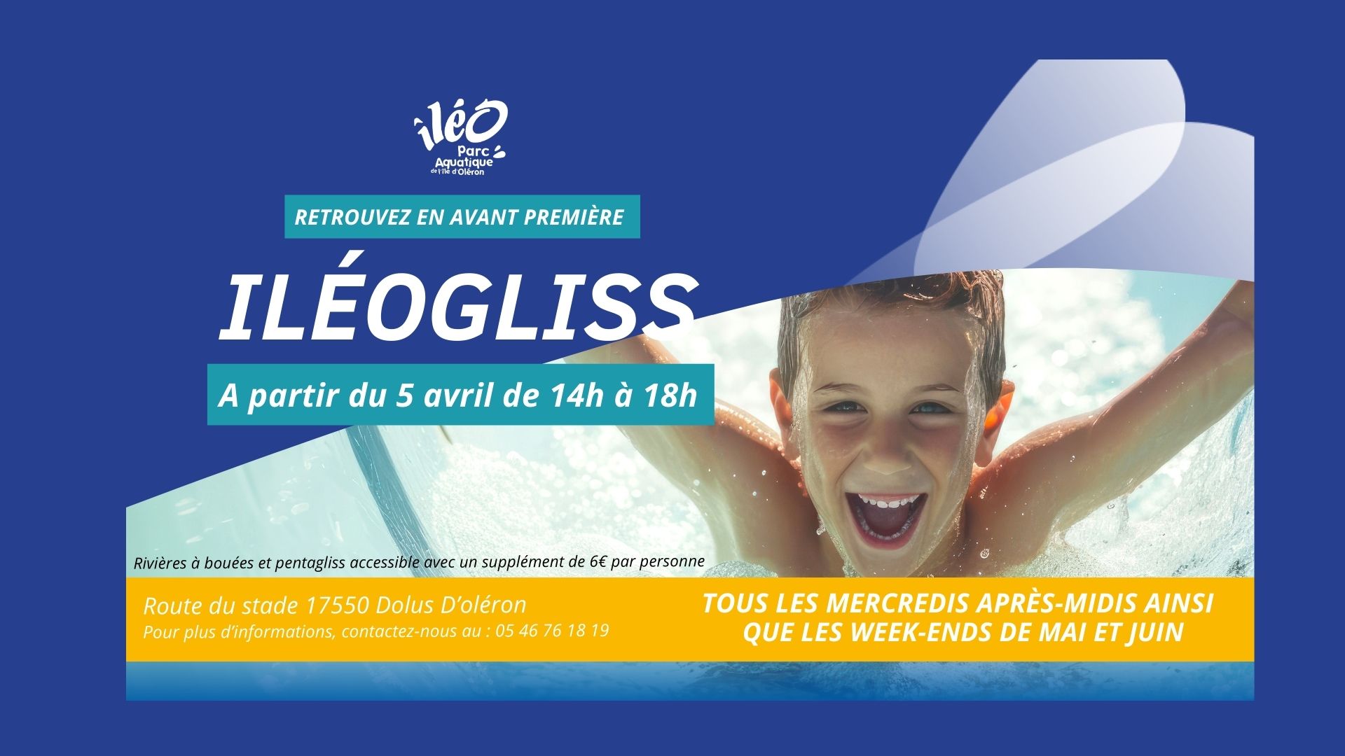 Ileogliss